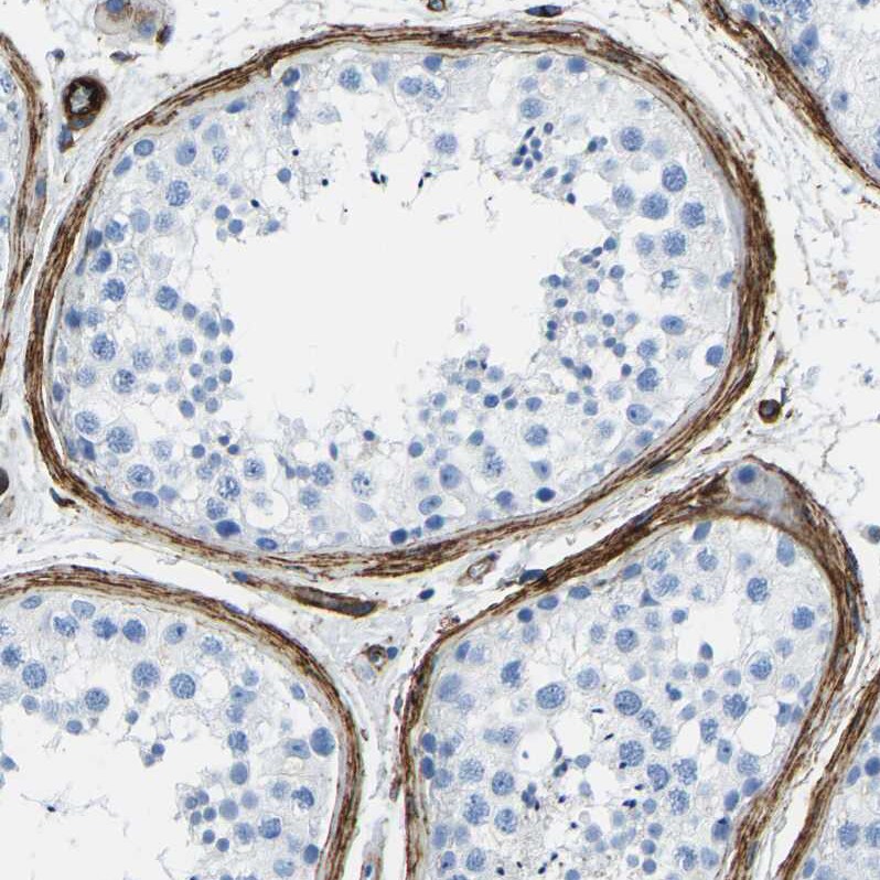 COL15A1 Antibody - BSA Free Immunohistochemistry-Paraffin: COL15A1 Antibody [NBP1-91087]