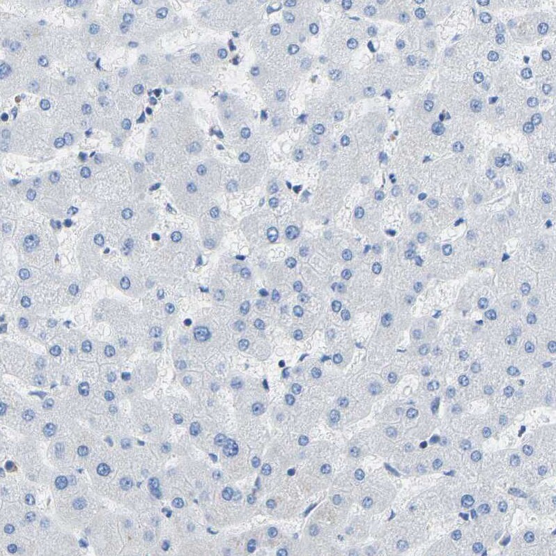 COL15A1 Antibody - BSA Free Immunohistochemistry-Paraffin: COL15A1 Antibody [NBP1-91087]