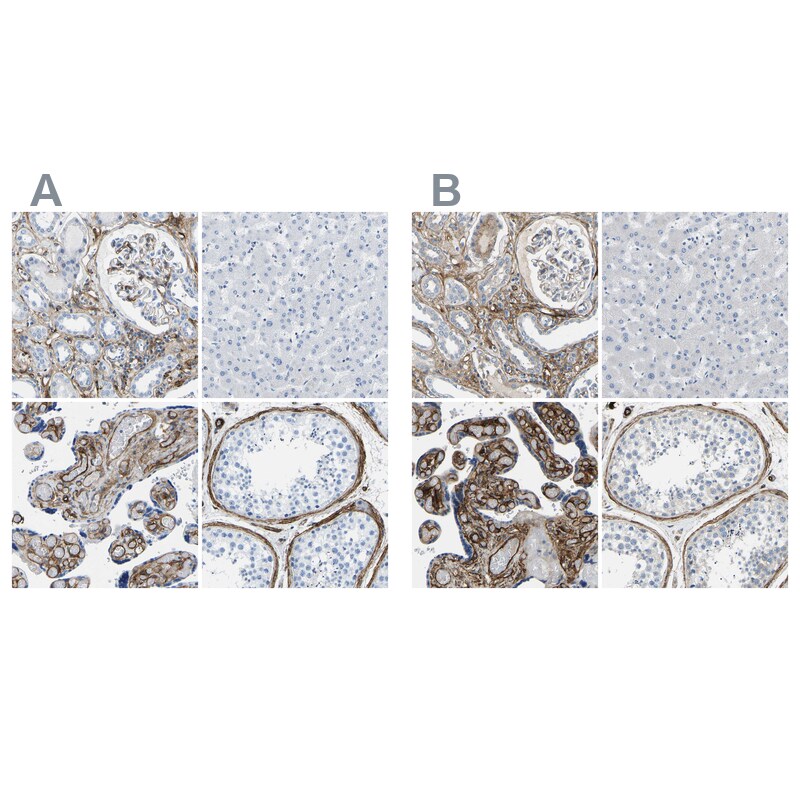 COL15A1 Antibody - BSA Free Immunohistochemistry-Paraffin: COL15A1 Antibody [NBP1-91087]