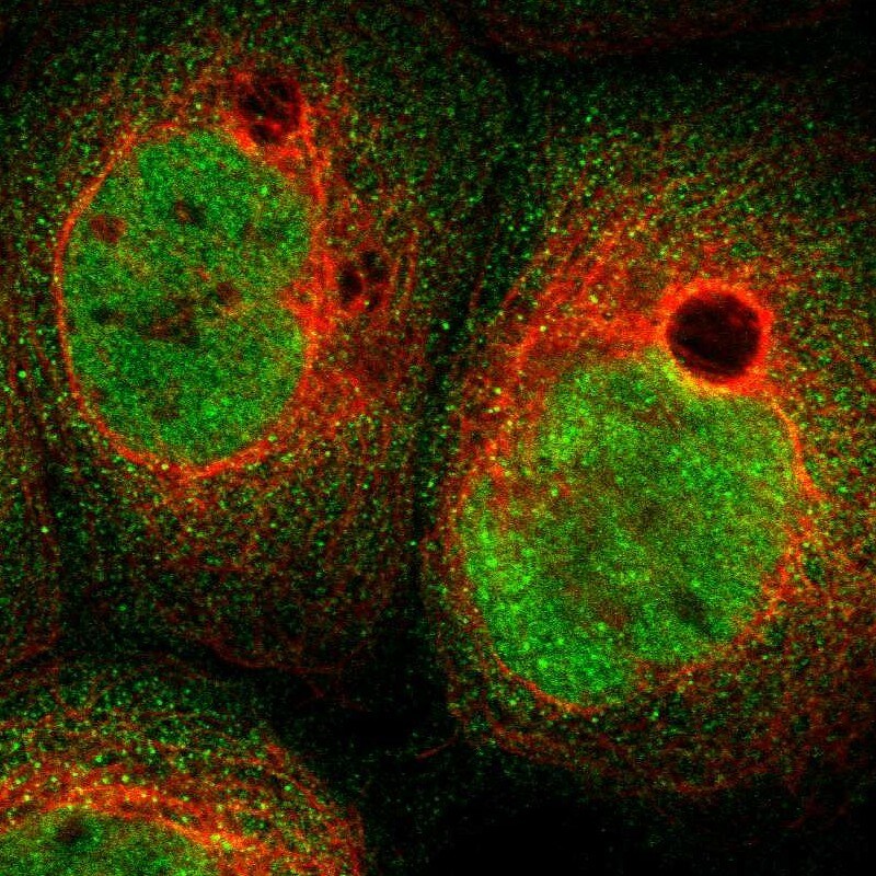 ABHD15 Antibody - BSA Free Immunocytochemistry/ Immunofluorescence: ABHD15 Antibody [NBP1-91100]