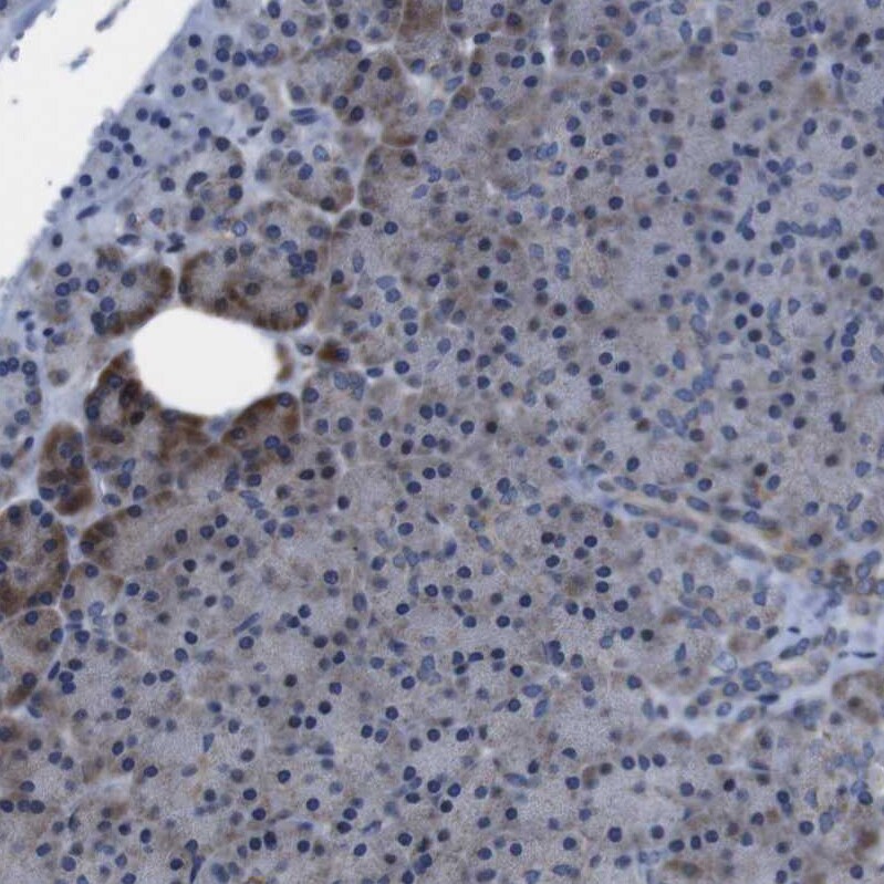SNN Antibody - BSA Free Immunohistochemistry: SNN Antibody - BSA Free [NBP1-91104]