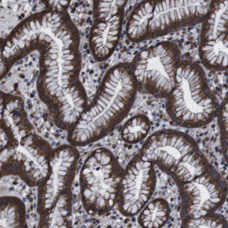 SNN Antibody - BSA Free Immunohistochemistry: SNN Antibody - BSA Free [NBP1-91104]