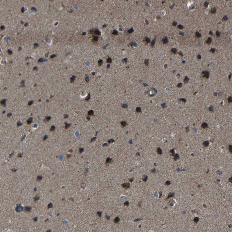 SNN Antibody - BSA Free Immunohistochemistry: SNN Antibody - BSA Free [NBP1-91104]