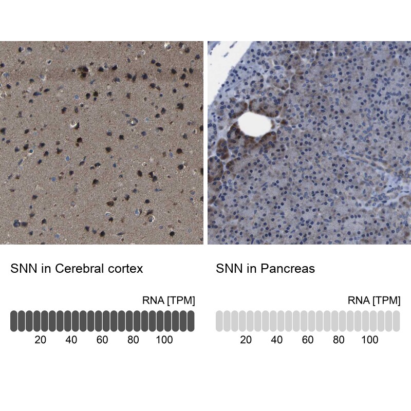 SNN Antibody - BSA Free Immunohistochemistry: SNN Antibody - BSA Free [NBP1-91104]