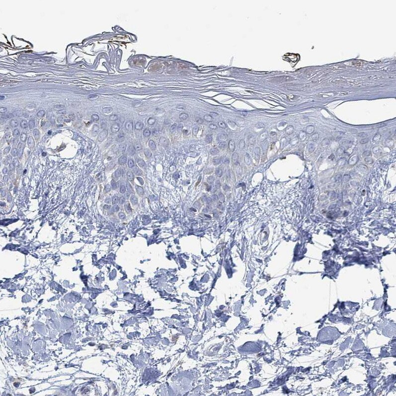 GLOD5 Antibody - BSA Free Immunohistochemistry: GLOD5 Antibody - BSA Free [NBP1-91105]
