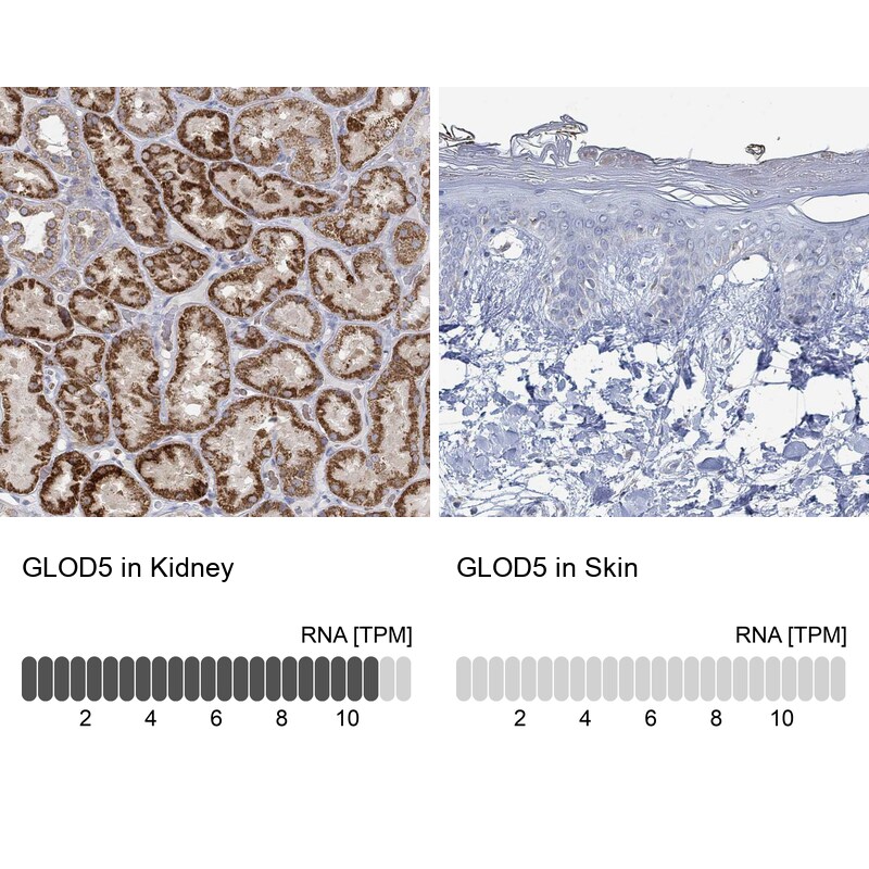 GLOD5 Antibody - BSA Free Immunohistochemistry: GLOD5 Antibody - BSA Free [NBP1-91105]
