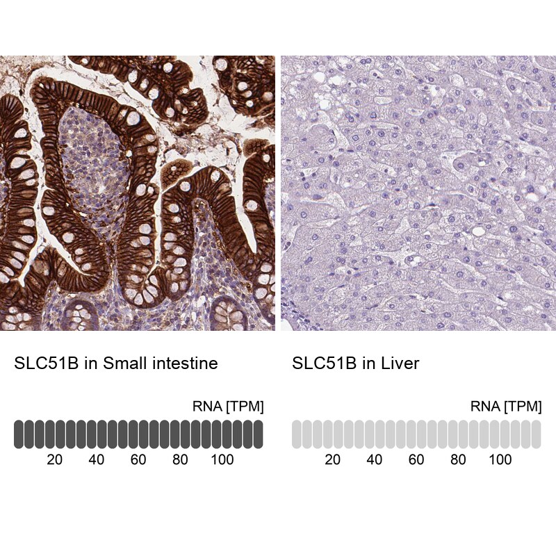 OSTB Antibody - BSA Free Immunohistochemistry: OSTB Antibody - BSA Free [NBP1-91108]