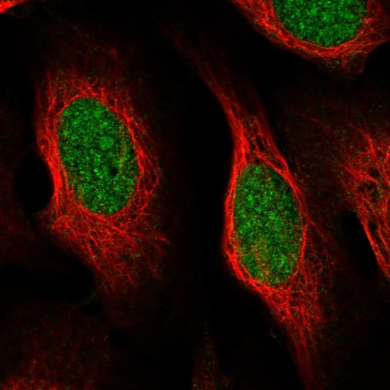 CCDC175 Antibody - BSA Free Immunocytochemistry/ Immunofluorescence: CCDC175 Antibody [NBP1-91111]
