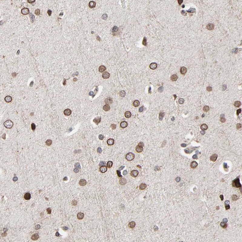 CCDC175 Antibody - BSA Free Immunohistochemistry: CCDC175 Antibody - BSA Free [NBP1-91111]