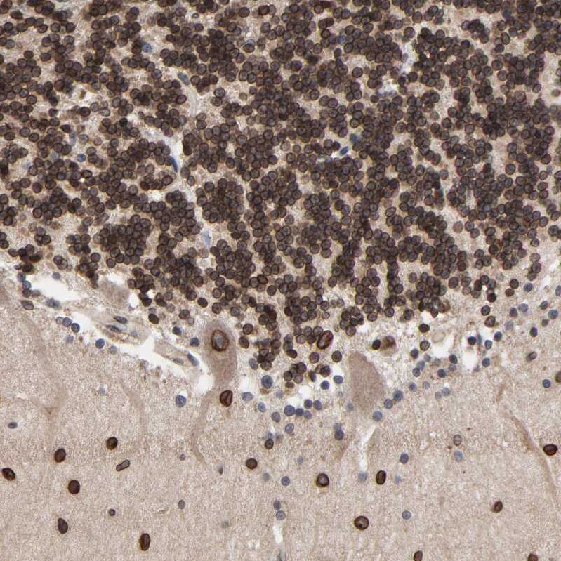 CCDC175 Antibody - BSA Free Immunohistochemistry: CCDC175 Antibody - BSA Free [NBP1-91111]