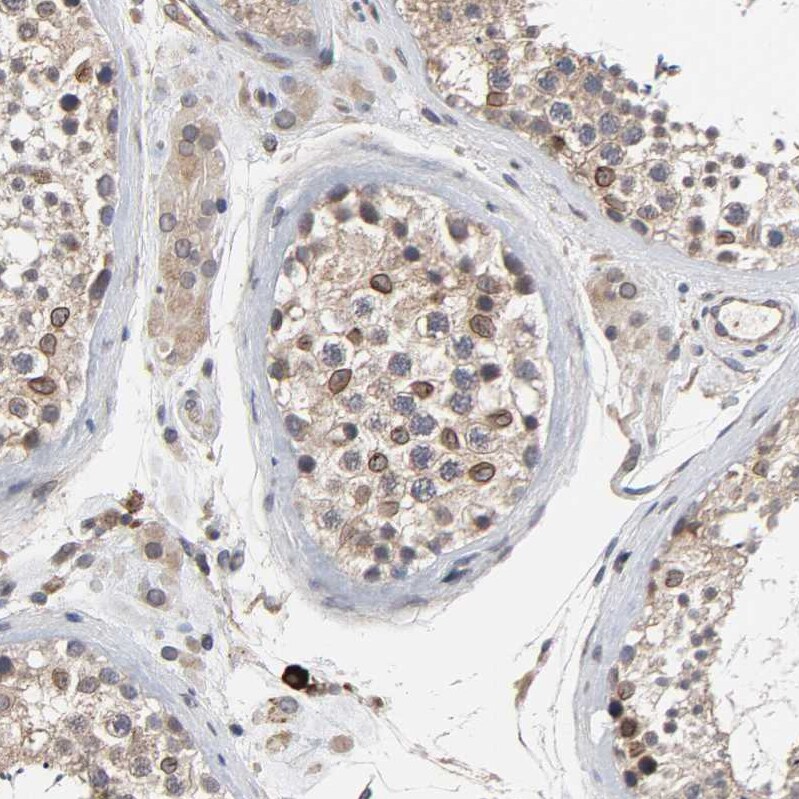 CCDC175 Antibody - BSA Free Immunohistochemistry: CCDC175 Antibody - BSA Free [NBP1-91111]
