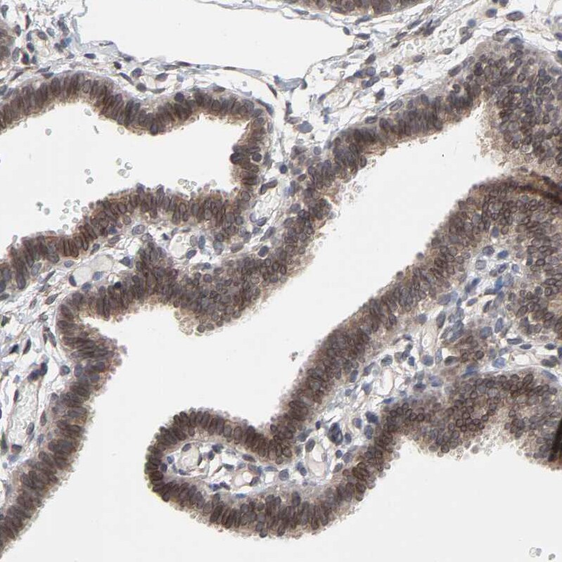 CCDC175 Antibody - BSA Free Immunohistochemistry: CCDC175 Antibody - BSA Free [NBP1-91111]
