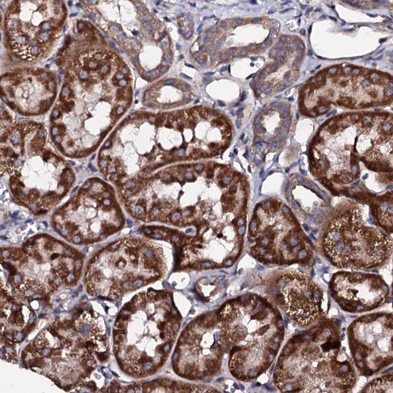 LIPT2 Antibody - BSA Free Immunohistochemistry: LIPT2 Antibody - BSA Free [NBP1-91135]