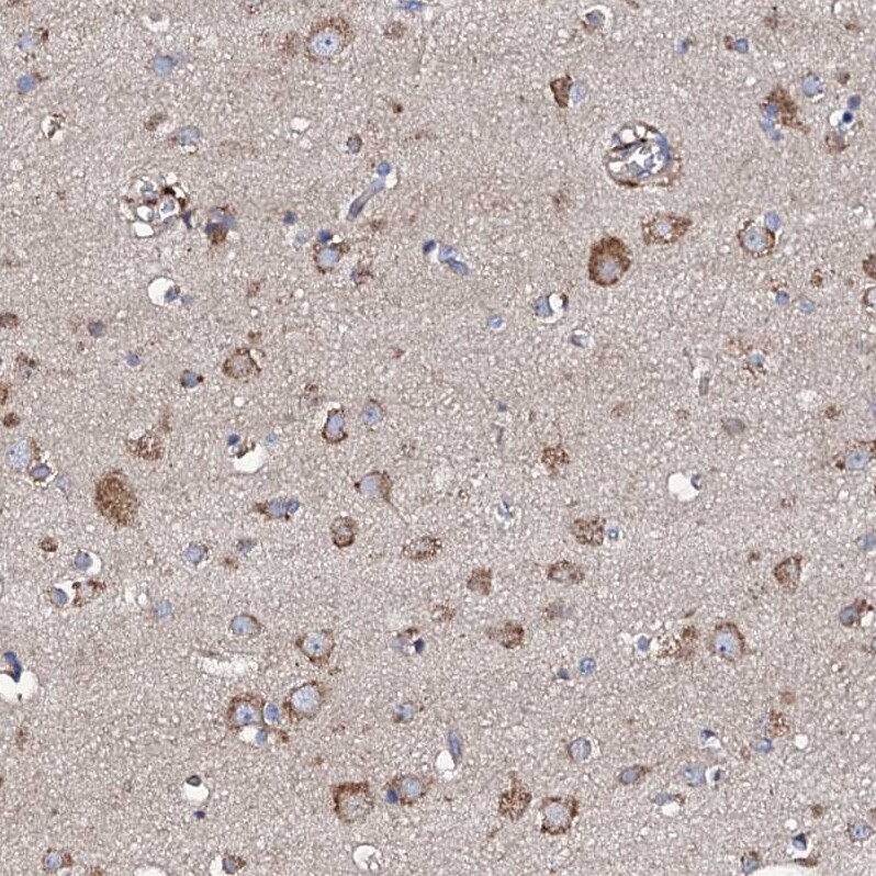 LIPT2 Antibody - BSA Free Immunohistochemistry: LIPT2 Antibody - BSA Free [NBP1-91135]
