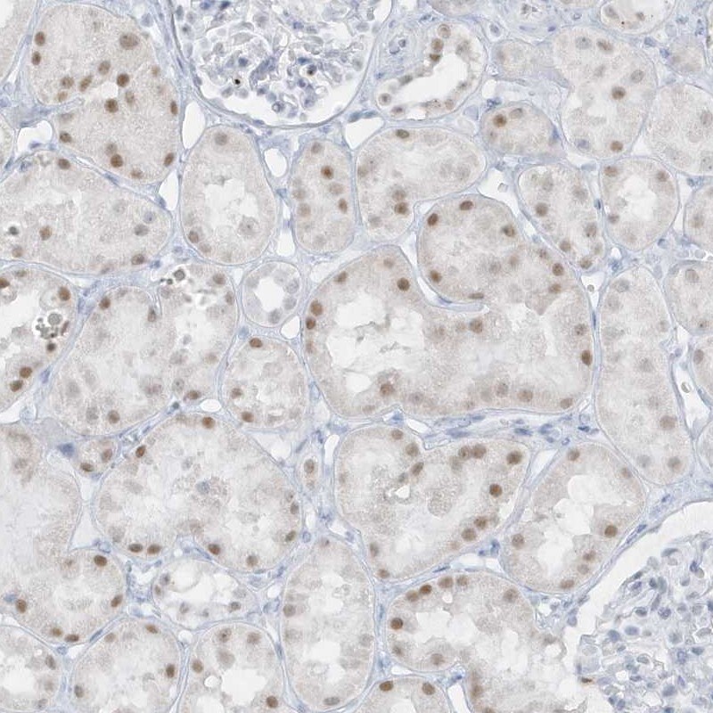 AP000322.53 Antibody - BSA Free Immunohistochemistry: AP000322.53 Antibody - BSA Free [NBP1-91141]