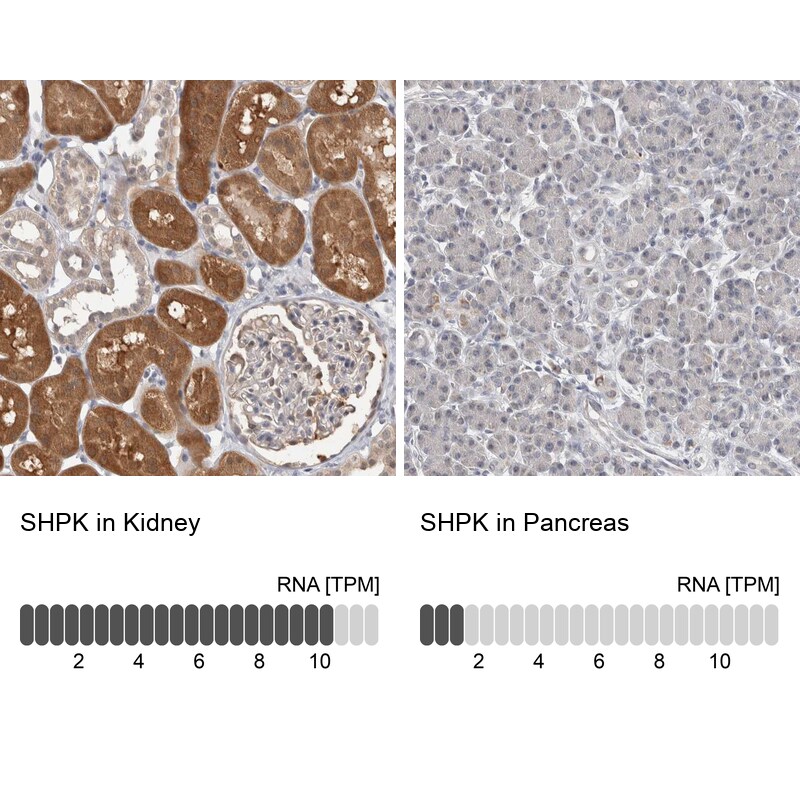 CARKL Antibody - BSA Free Immunohistochemistry: CARKL Antibody - BSA Free [NBP1-91151]