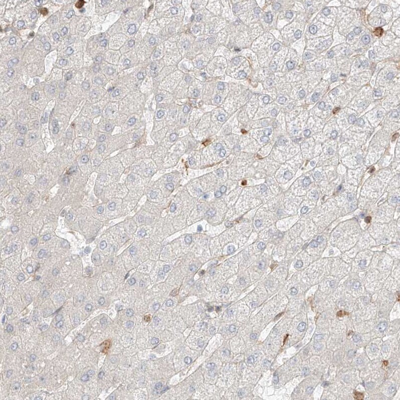 QN1 Antibody - BSA Free Immunohistochemistry: QN1 Antibody - BSA Free [NBP1-91158]