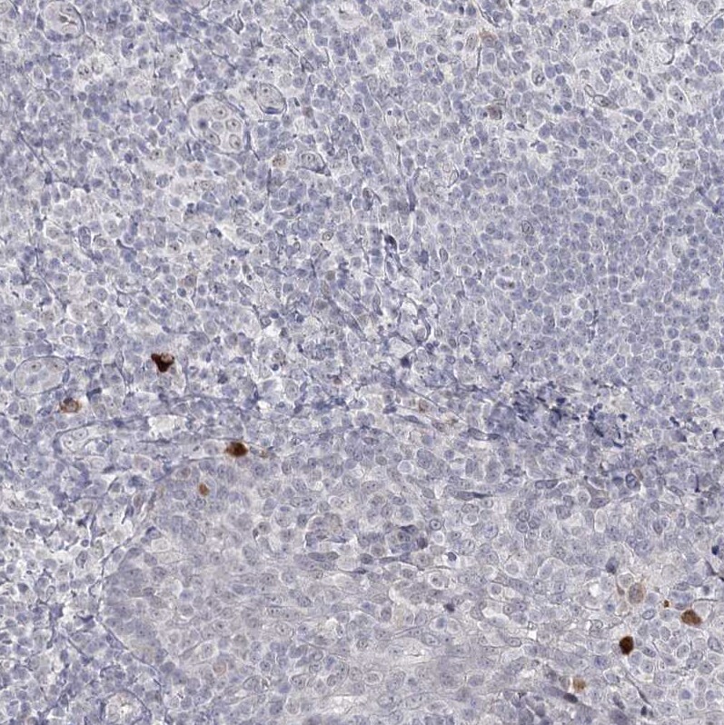 Ly-6G5C Antibody - BSA Free Immunohistochemistry-Paraffin: Ly-6G5C Antibody [NBP1-91160]