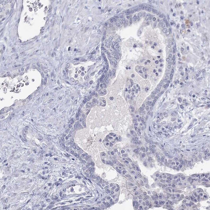 Ly-6G5C Antibody - BSA Free Immunohistochemistry-Paraffin: Ly-6G5C Antibody [NBP1-91160]