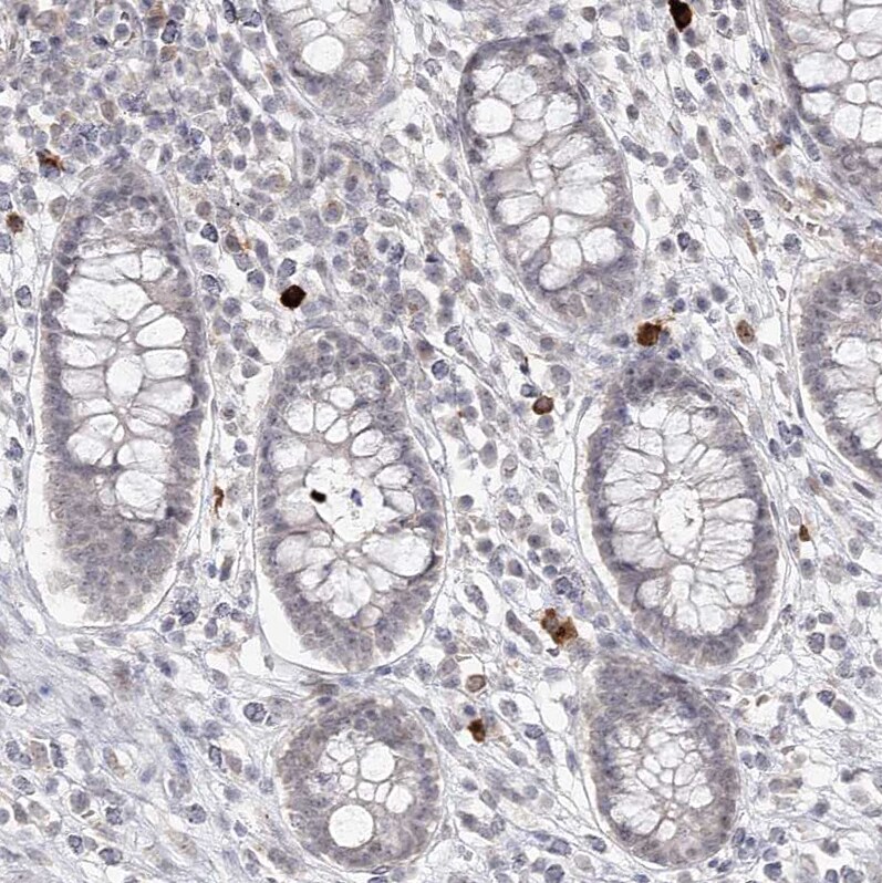 Ly-6G5C Antibody - BSA Free Immunohistochemistry-Paraffin: Ly-6G5C Antibody [NBP1-91160]