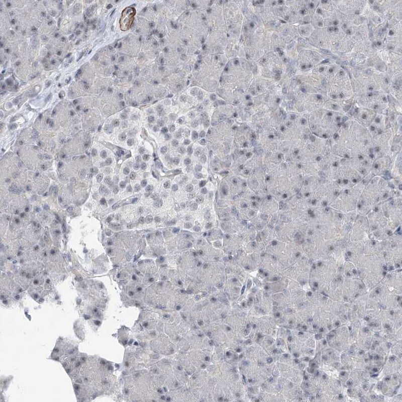 TXLNB Antibody - BSA Free Immunohistochemistry-Paraffin: TXLNB Antibody [NBP1-91161]