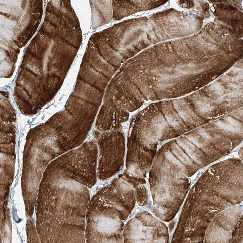 TXLNB Antibody - BSA Free Immunohistochemistry-Paraffin: TXLNB Antibody [NBP1-91161]