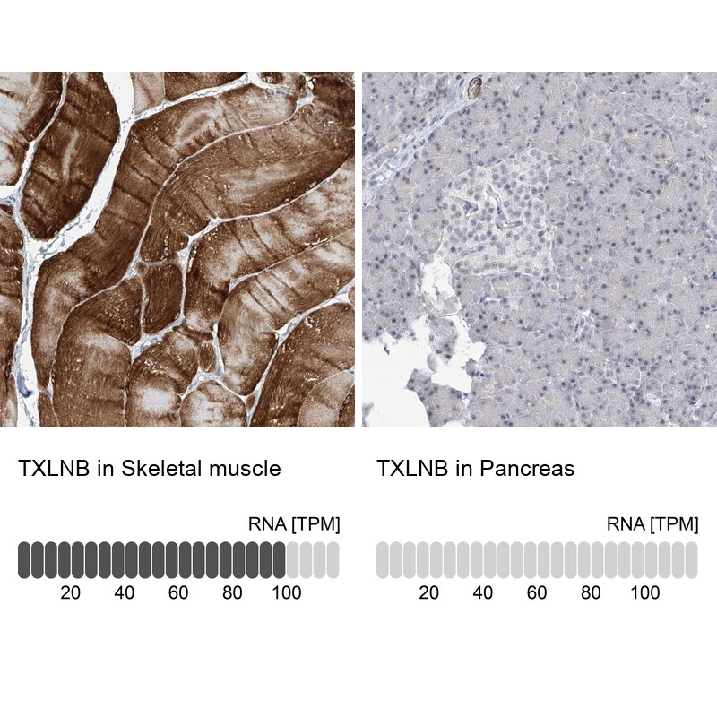 TXLNB Antibody - BSA Free Immunohistochemistry: TXLNB Antibody - BSA Free [NBP1-91161]