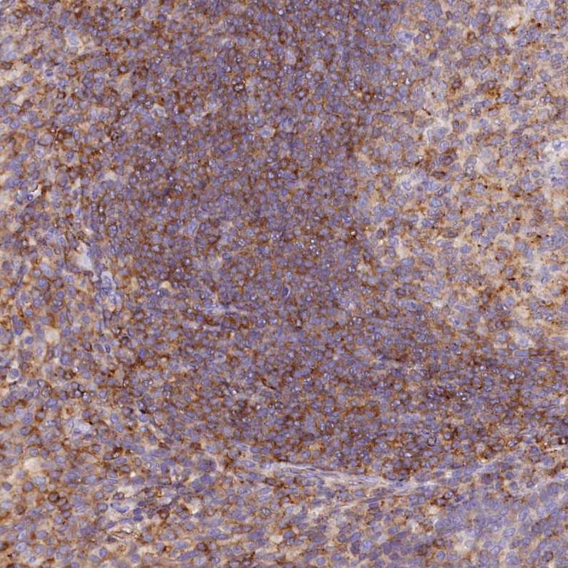 FAM193A Antibody - BSA Free Immunohistochemistry: FAM193A Antibody - BSA Free [NBP1-91165]