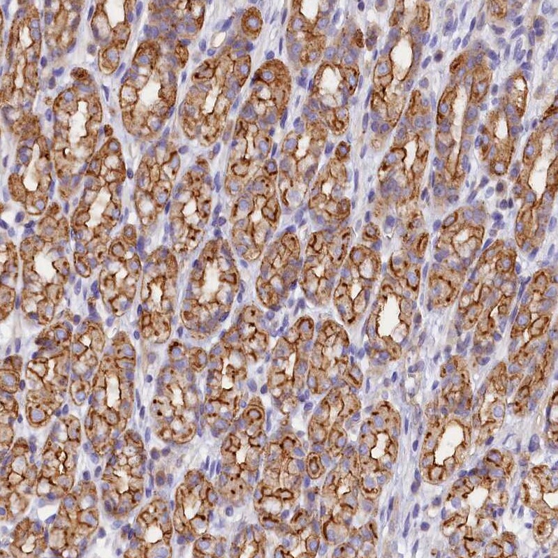 FAM193A Antibody - BSA Free Immunohistochemistry: FAM193A Antibody - BSA Free [NBP1-91165]