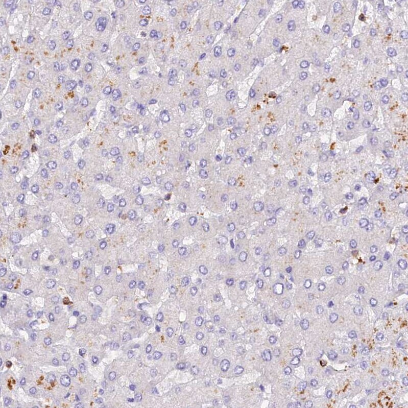 FAM193A Antibody - BSA Free Immunohistochemistry: FAM193A Antibody - BSA Free [NBP1-91165]