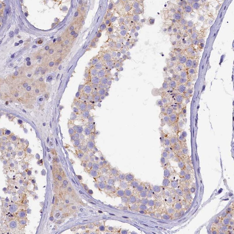FAM193A Antibody - BSA Free Immunohistochemistry: FAM193A Antibody - BSA Free [NBP1-91165]
