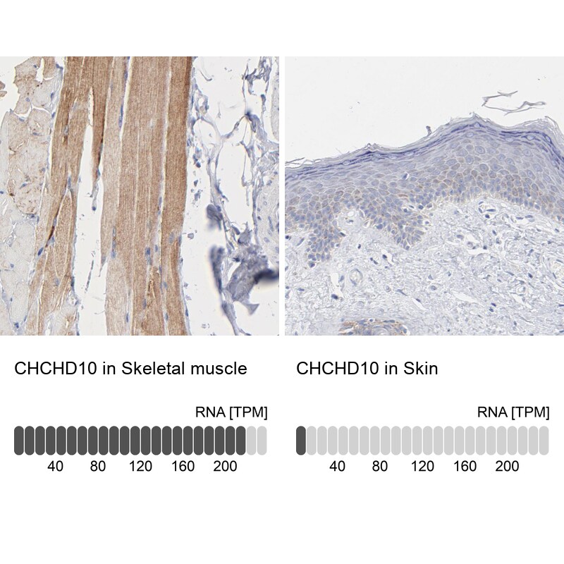 CHCHD10 Antibody - BSA Free Immunohistochemistry: CHCHD10 Antibody - BSA Free [NBP1-91169]