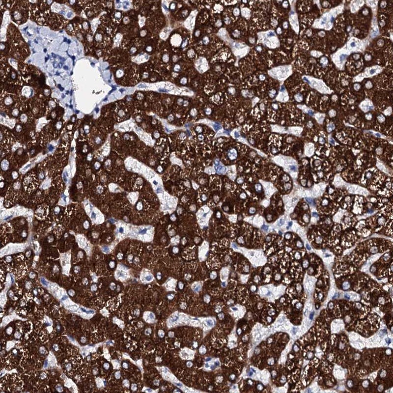 Glycogen synthase 2 Antibody - BSA Free Immunohistochemistry-Paraffin: Glycogen synthase 2 Antibody [NBP1-91191]