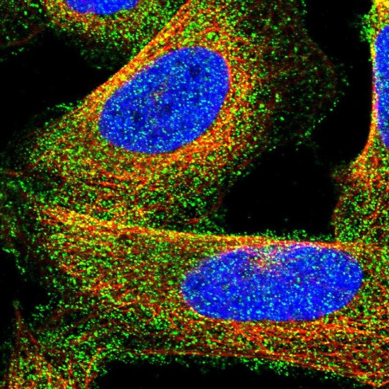 Collagen VI alpha 1 Antibody - BSA Free Immunocytochemistry/ Immunofluorescence: Collagen VI alpha 1 Antibody [NBP1-91195]