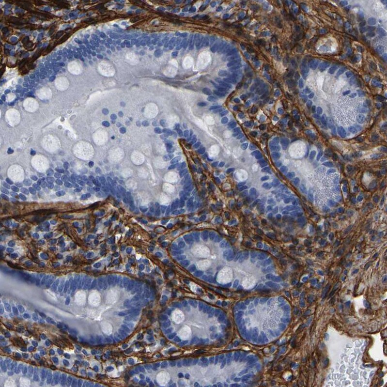 Collagen VI alpha 1 Antibody - BSA Free Immunohistochemistry: Collagen VI alpha 1 Antibody - BSA Free [NBP1-91195]