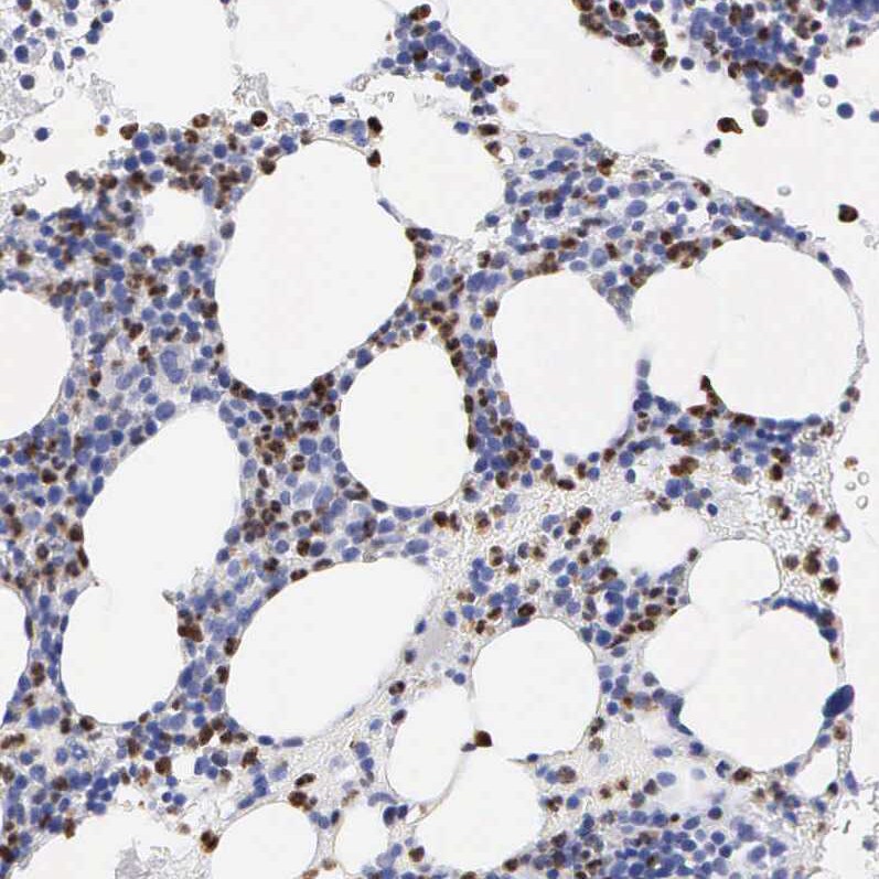 SPIN3 Antibody - BSA Free Immunohistochemistry: SPIN3 Antibody - BSA Free [NBP1-91204]