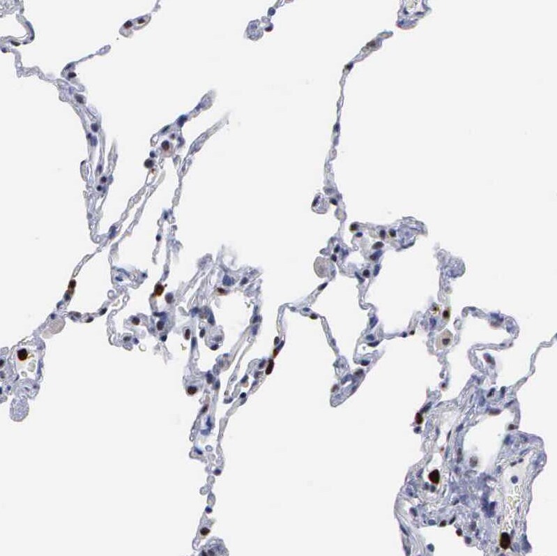 SPIN3 Antibody - BSA Free Immunohistochemistry: SPIN3 Antibody - BSA Free [NBP1-91204]