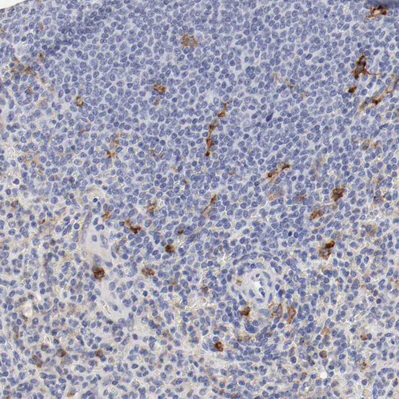 CD11c Antibody - BSA Free Immunohistochemistry: CD11c Antibody - BSA Free [NBP1-91210]