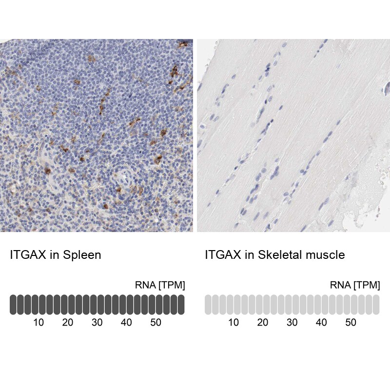 CD11c Antibody - BSA Free Immunohistochemistry: CD11c Antibody - BSA Free [NBP1-91210]