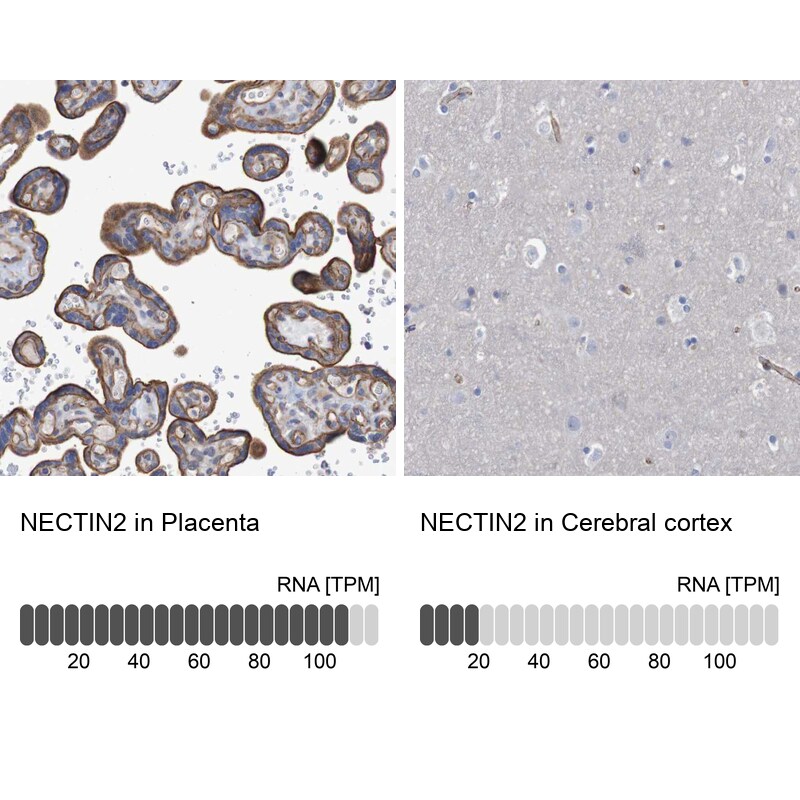Nectin-2/CD112 Antibody - BSA Free Immunohistochemistry: Nectin-2/CD112 Antibody - BSA Free [NBP1-91211]