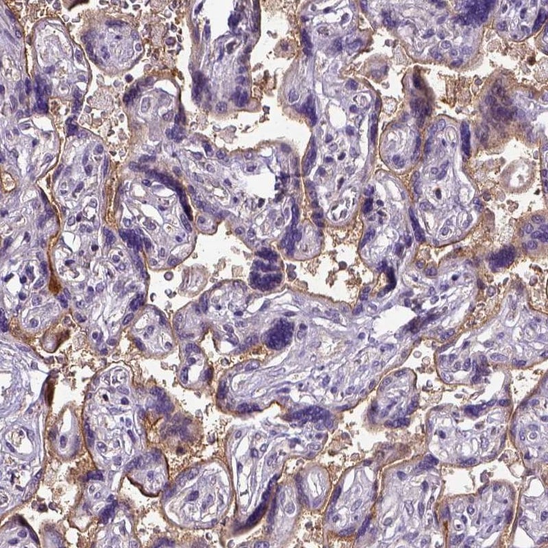 Endoglin/CD105 Antibody - BSA Free Immunohistochemistry: Endoglin/CD105 Antibody - BSA Free [NBP1-91212]