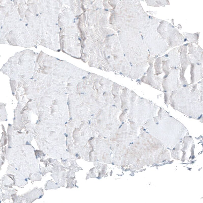 CDK20 Antibody - BSA Free Immunohistochemistry: CDK20 Antibody - BSA Free [NBP1-91214]