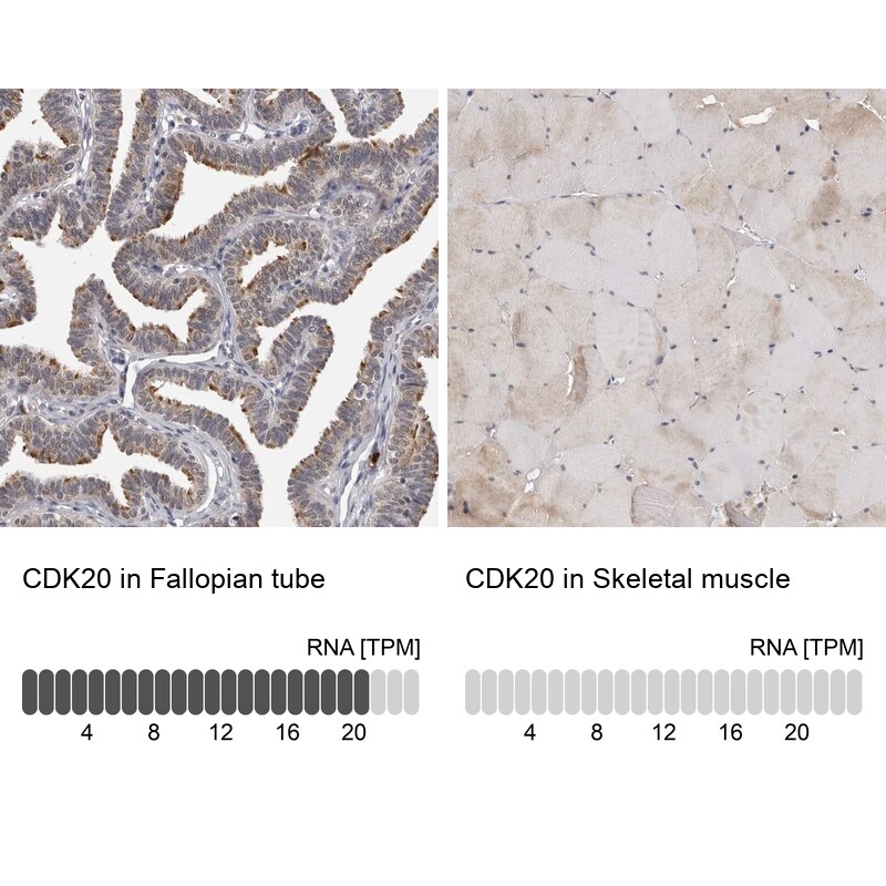 CDK20 Antibody - BSA Free Immunohistochemistry: CDK20 Antibody - BSA Free [NBP1-91215]