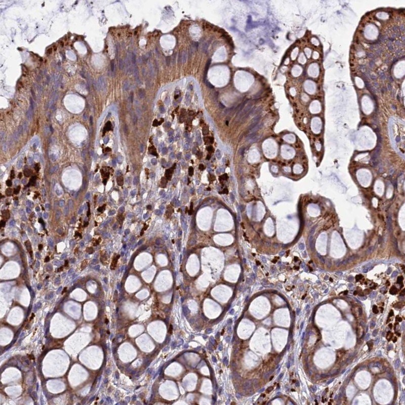 RLTPR Antibody - BSA Free Immunohistochemistry: RLTPR Antibody - BSA Free [NBP1-91220]