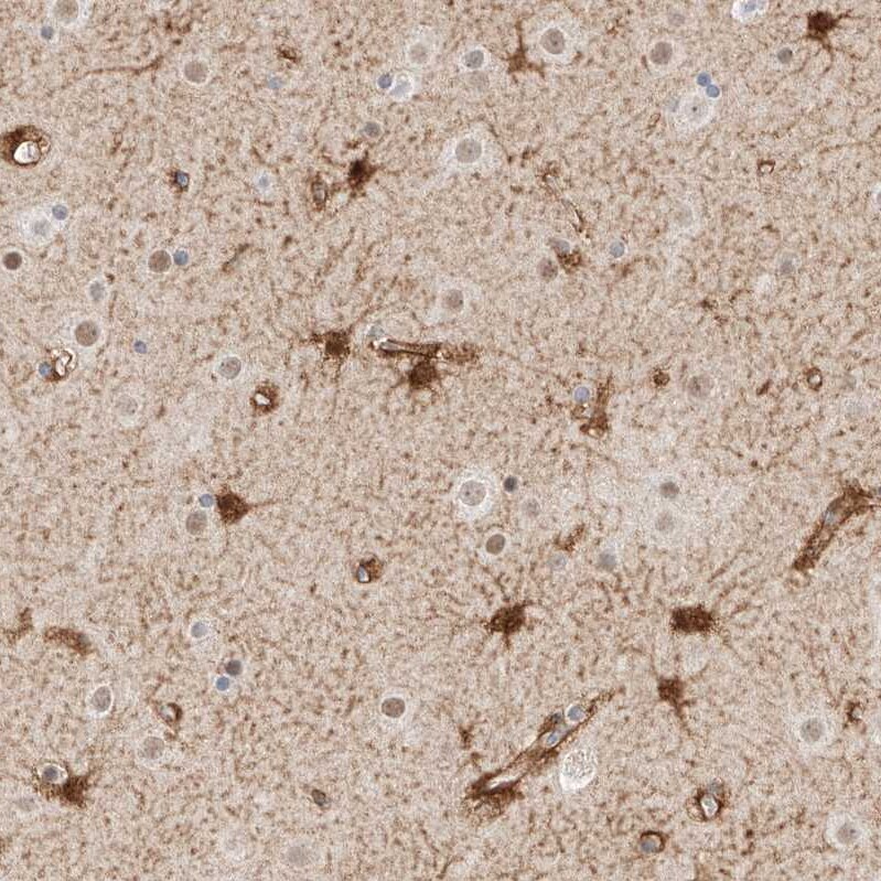 LRRC16A Antibody - BSA Free Immunohistochemistry: LRRC16A Antibody - BSA Free [NBP1-91221]