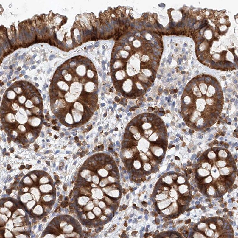 LRRC16A Antibody - BSA Free Immunohistochemistry: LRRC16A Antibody - BSA Free [NBP1-91222]