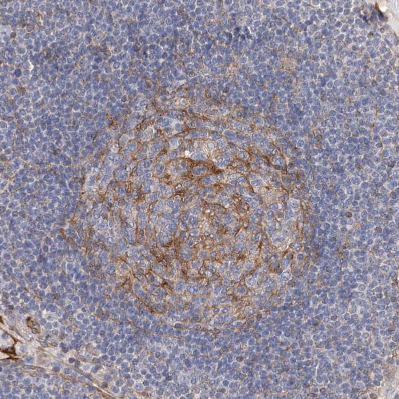 LRRC16A Antibody - BSA Free Immunohistochemistry: LRRC16A Antibody - BSA Free [NBP1-91222]