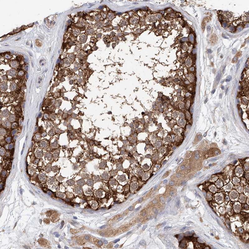 LRRC16A Antibody - BSA Free Immunohistochemistry: LRRC16A Antibody - BSA Free [NBP1-91222]