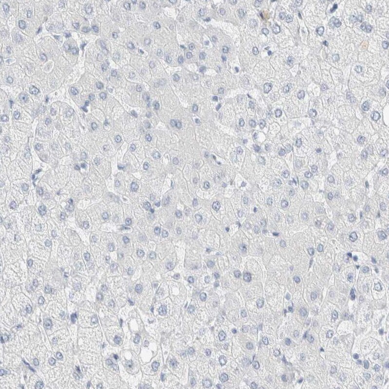 ARHGAP27 Antibody - BSA Free Immunohistochemistry: ARHGAP27 Antibody - BSA Free [NBP1-91223]
