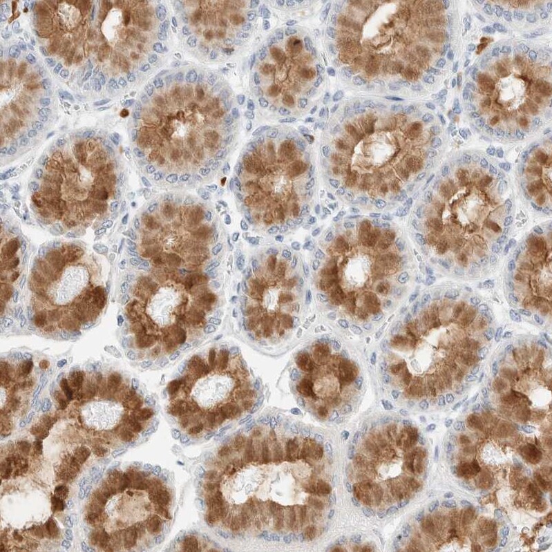 ARHGAP27 Antibody - BSA Free Immunohistochemistry: ARHGAP27 Antibody - BSA Free [NBP1-91223]